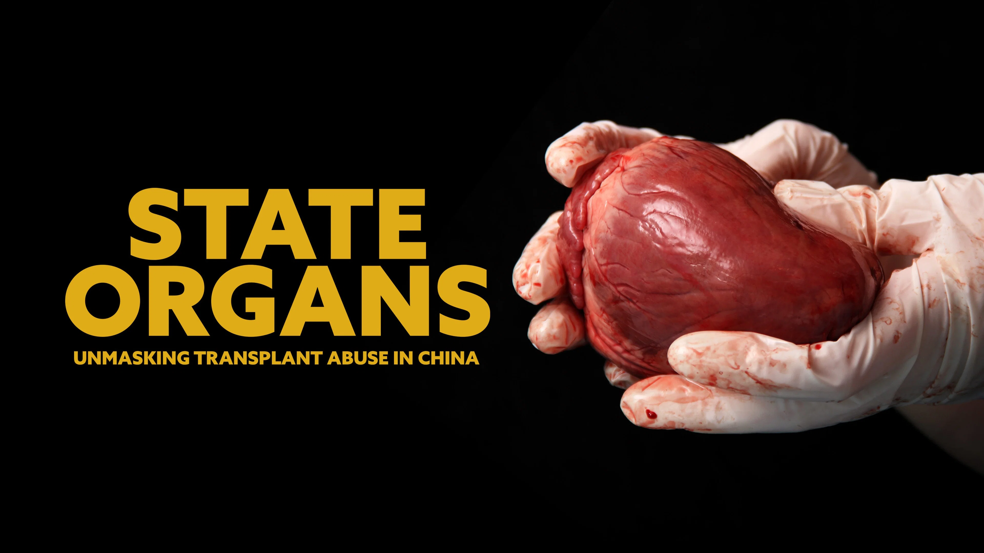 Backdrop for State Organs: Unmasking Transplant Abuse in China